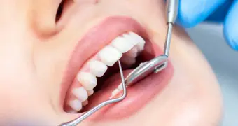 Найден сигнал, который запускает восстановление зубов у человека