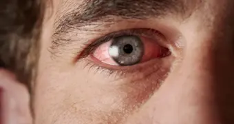 Препарат для похудения может лишить зрения: ученые предупреждают о глазном инсульте