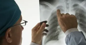 Врач объяснил, почему болезнь лёгких развивается не у всех курильщиков