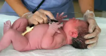 В Мангистау уменьшилось число случаев внутриутробной инфекции у детей