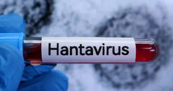 Хантавирус вновь напугал мир после COVID: почему ученые говорят о новой угрозе