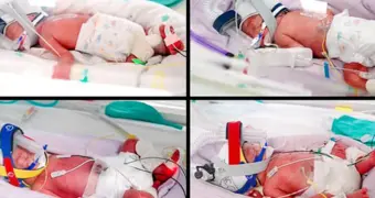 Мать четверых детей родила еще четверняшек — теперь в семье сразу восемь детей