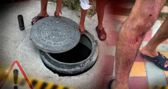 Ссадины и шрамы: в Актау парень провалился в люк у супермаркета