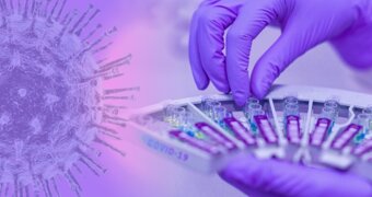 «Крысиная лихорадка» добралась до Казахстана — в Минздраве рассказали о двух случаях