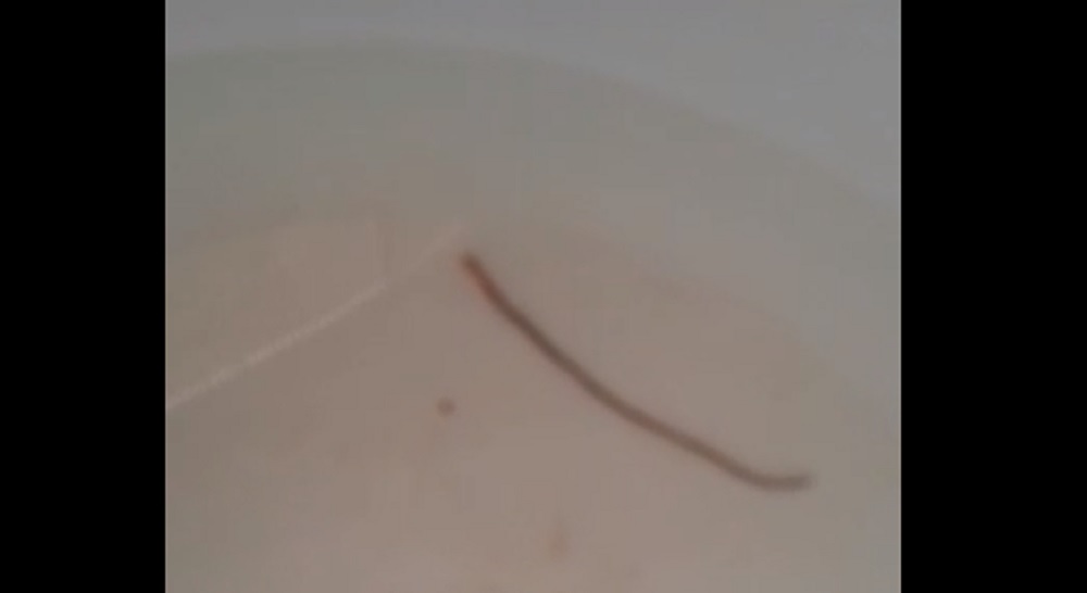 Черные черви в воде. Червячки в воде из крана. Белые черви в воде из крана. Глисты в воде из под крана.