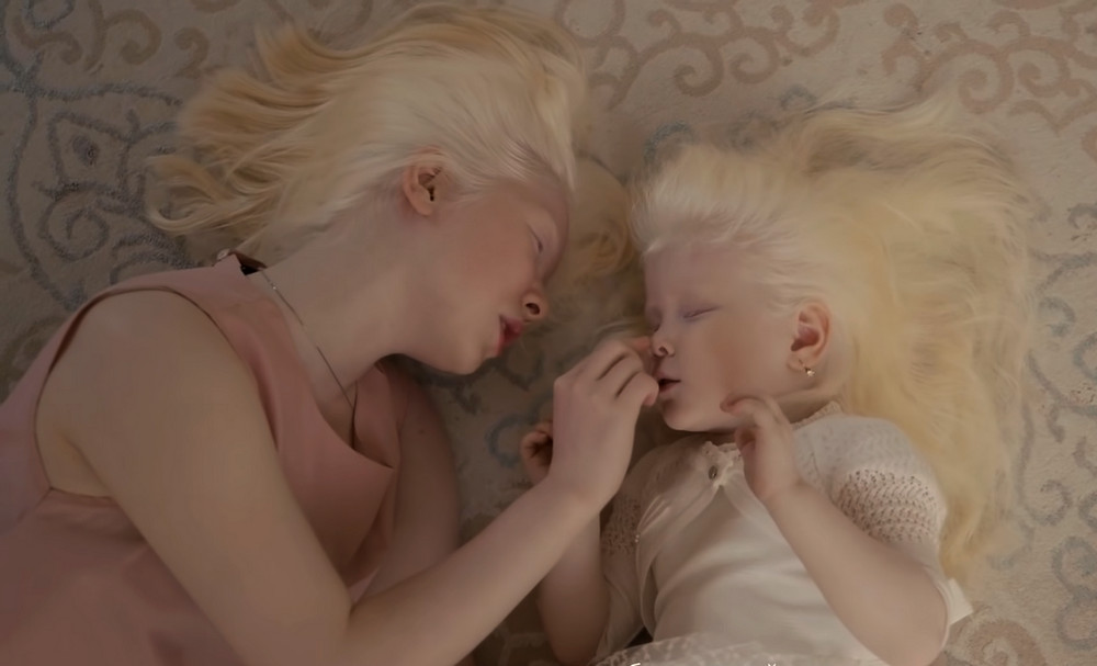 Сёстры-альбиносы Асель и Камилла Калагановы. Кадр видео