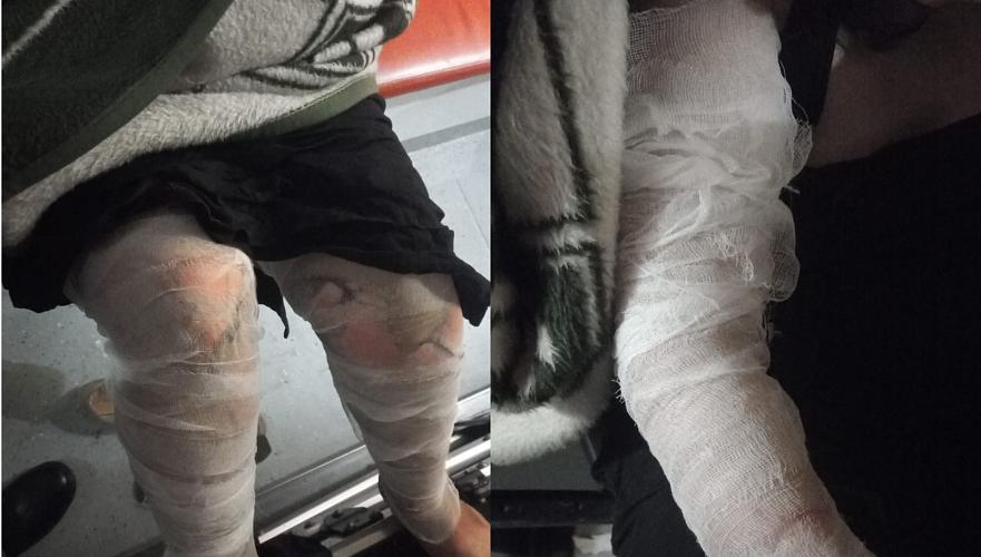 Казахстанцы получили ожоги в загоревшемся на ходу такси — один из пассажиров в реанимации