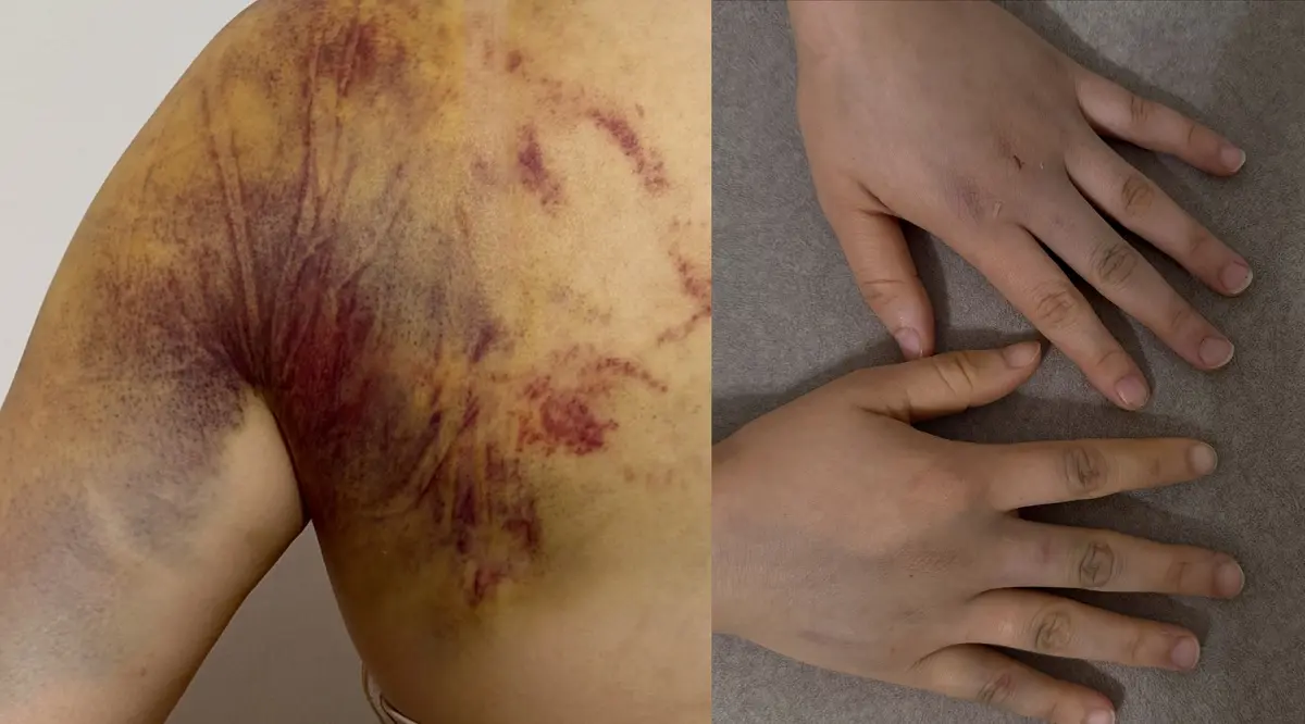 Фото предоставлено родственниками пострадавшей