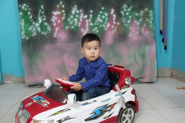 Фонд «Адал» собирает средства на операцию трехлетнему Жанузаку