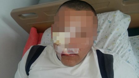 В ДВД Мангистау прокомментировали распространяемое в социальных сетях сообщение об избиении жителя Актау