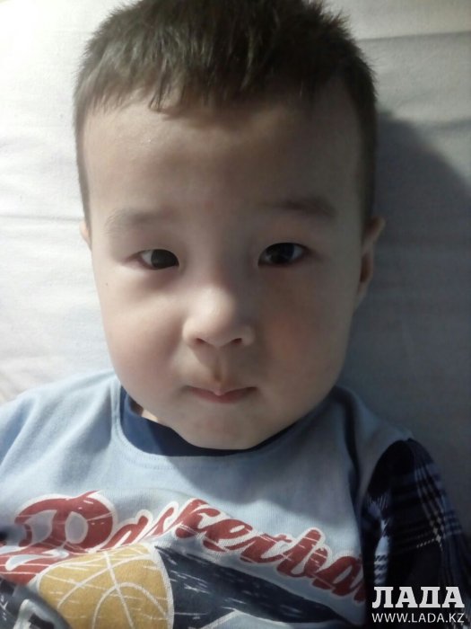 Трехлетнего жителя Актау Жанузака Айтбая прооперировали в клинике Санкт-Петербурга