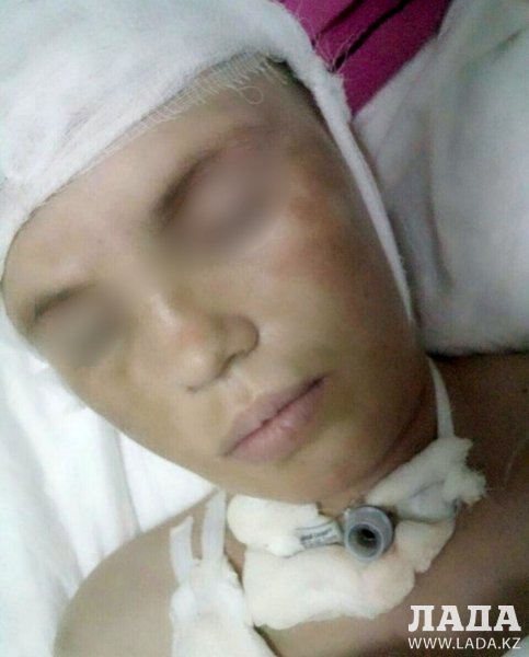 В Актау семье избитой девушки требуется помощь