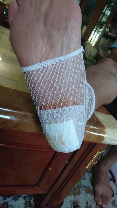 Осторожно, тёплый пляж