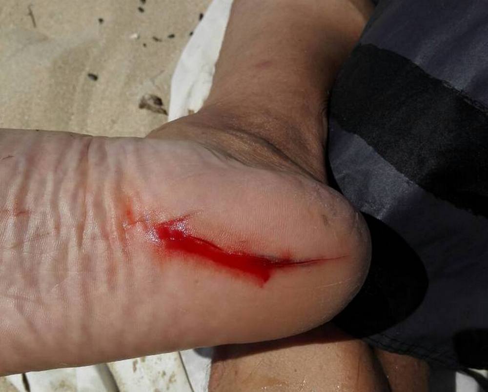 Осторожно, тёплый пляж