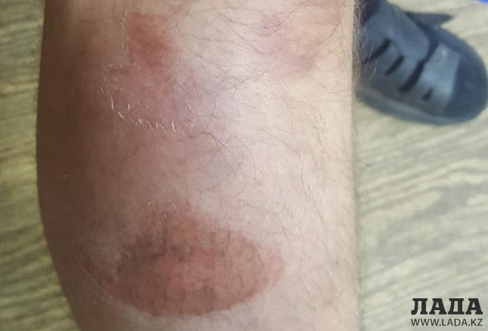 Автобус сбил велосипедиста в Актау