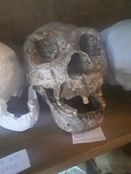 У людей исчезнут обоняние, берцовая кость и зубы мудрости – антрополог