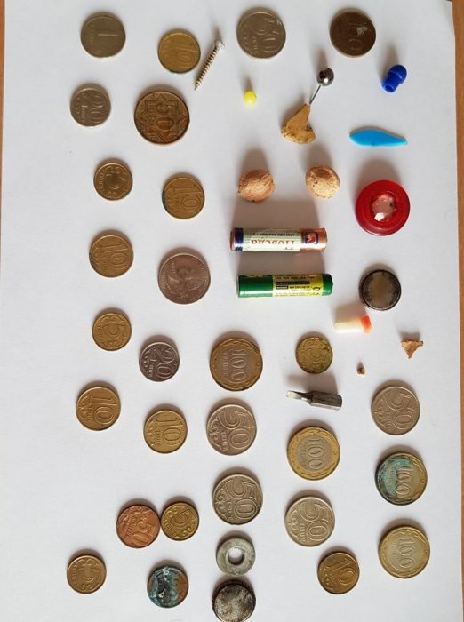 В Актау  из пищевода годовалого ребенка врачи извлекли батарейку