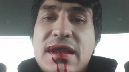 В Узбекистане блогеру порвали рот
