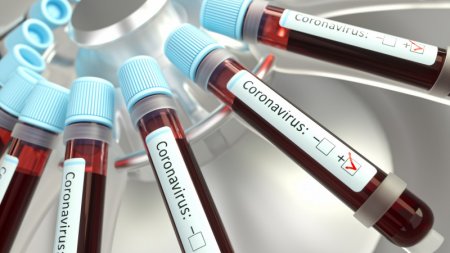 Третий случай коронавируса зарегистрирован в Казахстане