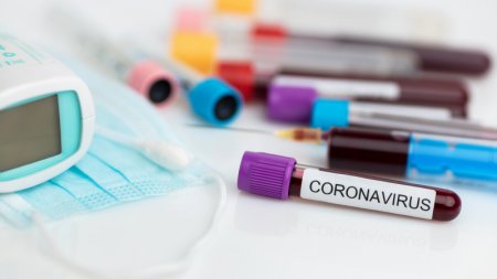 302 случая коронавируса зарегистрированы в Казахстане