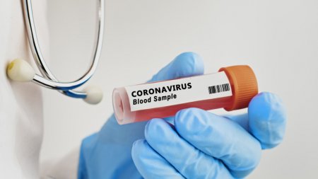 Ещё 23 случая коронавируса зарегистрированы в Казахстане
