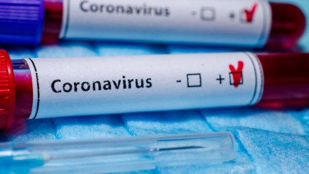 Зарегистрировано еще 20 новых случаев заражения коронавирусной инфекцией