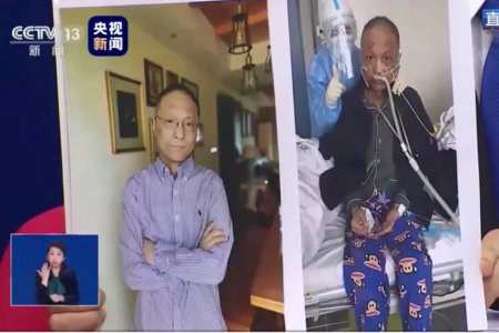 Почерневший от COVID-19 врач начал светлеть