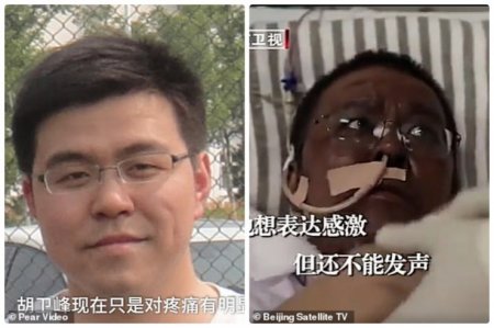 Почерневший от COVID-19 врач начал светлеть