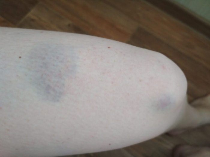 Жители Актау просят запретить электрокары в парке «Акбота»