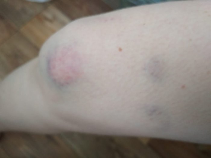 Жители Актау просят запретить электрокары в парке «Акбота»