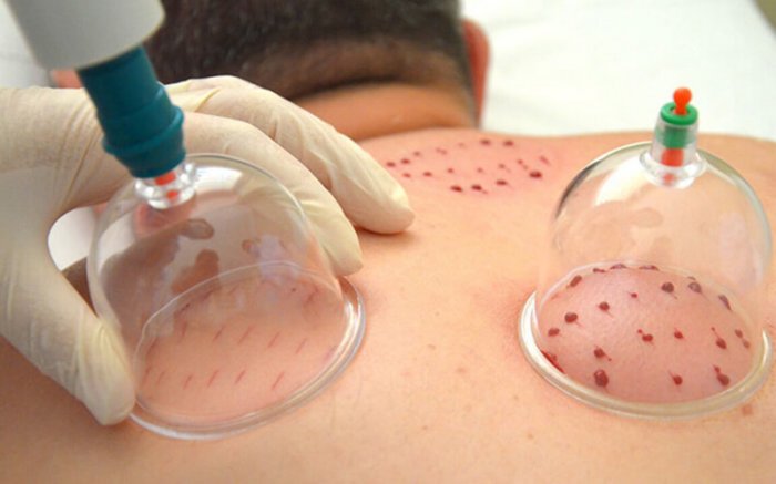 Жителям Актау рассказали о вредных советах при лечении Covid-19