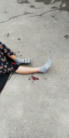 Еще один козырёк обвалился в Актау: пострадала женщина