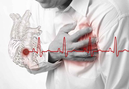 Новая опасность: COVID-19 вызывает синдром разбитого сердца