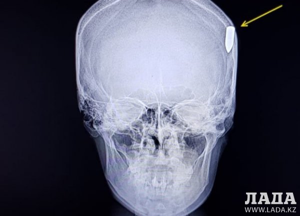 Загадочный инцидент произошел с солдатом из воинской части в Актау