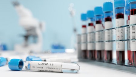 Снизить стоимость тестов на коронавирус поручил Токаев