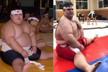 Умер "самый толстый малыш в мире"