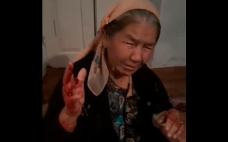 Дочери и зятья избили пожилую мать и сломали ей руку в Шымкенте