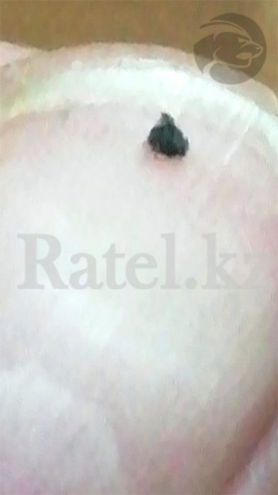 Неопознанные твари лезут из кожи детей-инвалидов после отдыха в санатории Актау