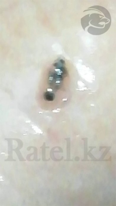 Неопознанные твари лезут из кожи детей-инвалидов после отдыха в санатории Актау