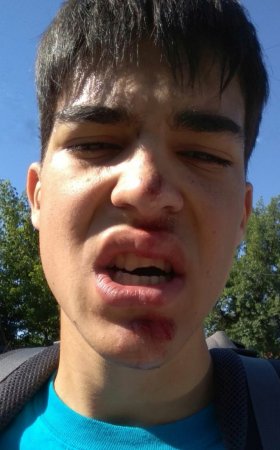 "Это не удача". Выживший после "падения глыбы" рассказал об инциденте