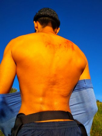 "Это не удача". Выживший после "падения глыбы" рассказал об инциденте