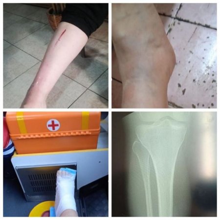 В шаге от смерти – столб с "Сергеком" упал на женщину