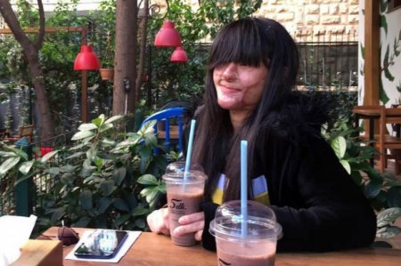 Девушка вышла замуж за парня, облившего ее серной кислотой