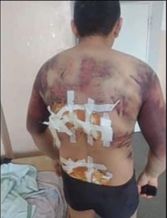 Гепрокуратура прокомментировала пытки утюгом талдыкорганца