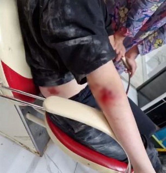 Собаки напали на девочку в Жанаозене