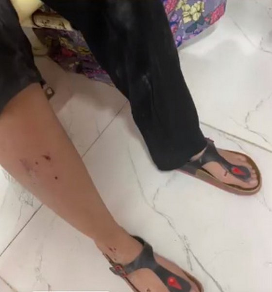 Собаки напали на девочку в Жанаозене