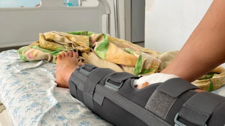 Актауские врачи успешно прооперировали пострадавшую туристку из России