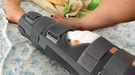 Актауские врачи успешно прооперировали пострадавшую туристку из России