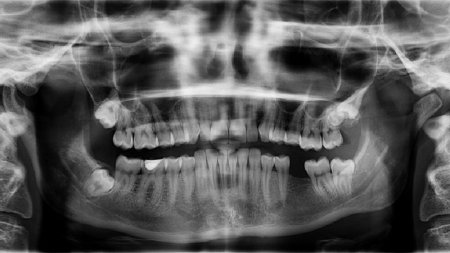 Стоматолог: сон на боку меняет прикус и форму лица