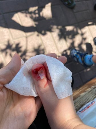 Облицовочная плитка упала на ребенка в столичном парке